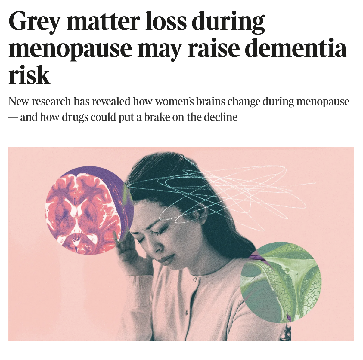 Times-meno-dementia